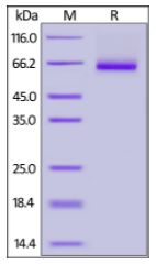 Human IL-2 R beta, Fc Tag on SDS-PAGE under reducing (R) condition. The gel was stained overnight with Coomassie Blue. The purity of the protein is greater than 92%.